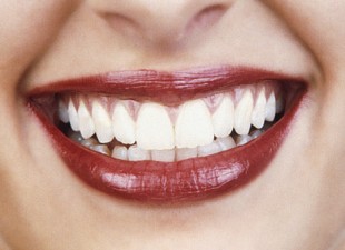 Četiri prirodna preparata za beljenje zuba